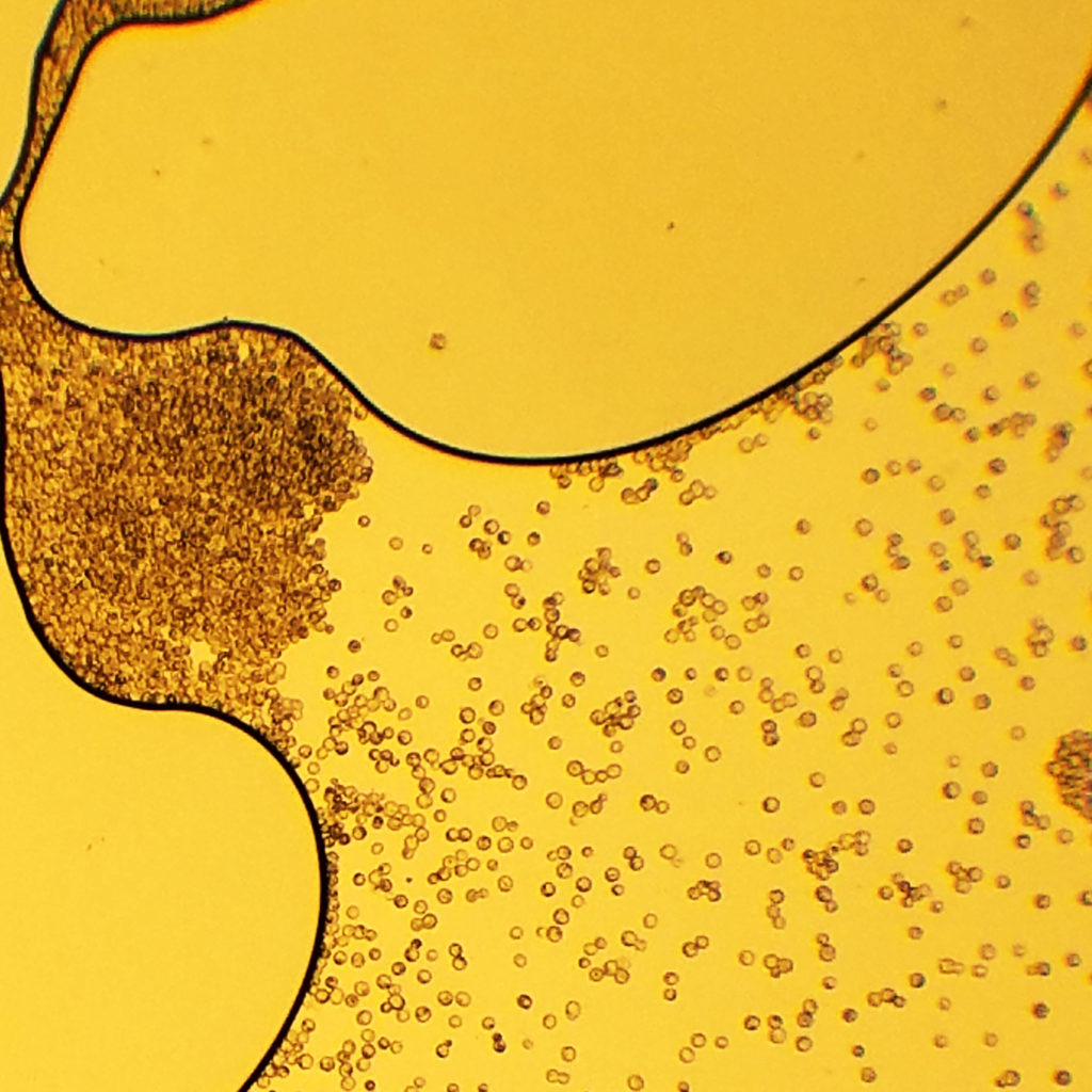 Yeast through microscope